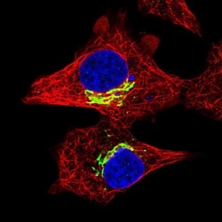 RFK Antibody, Novus Biologicals 25 &mu;L, Unlabeled:Antibodies, Polyclonal
